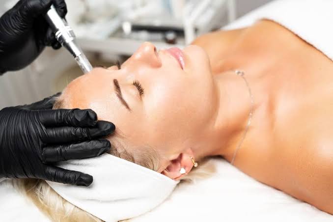 PRP, PRF și microneedling în Iași pentru tratamente de rejuvenare facială