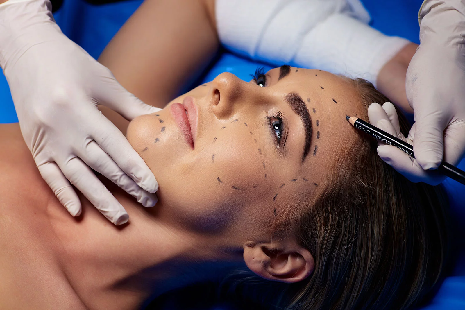 Remodelare facială cu stimulatoare de colagen în Iași