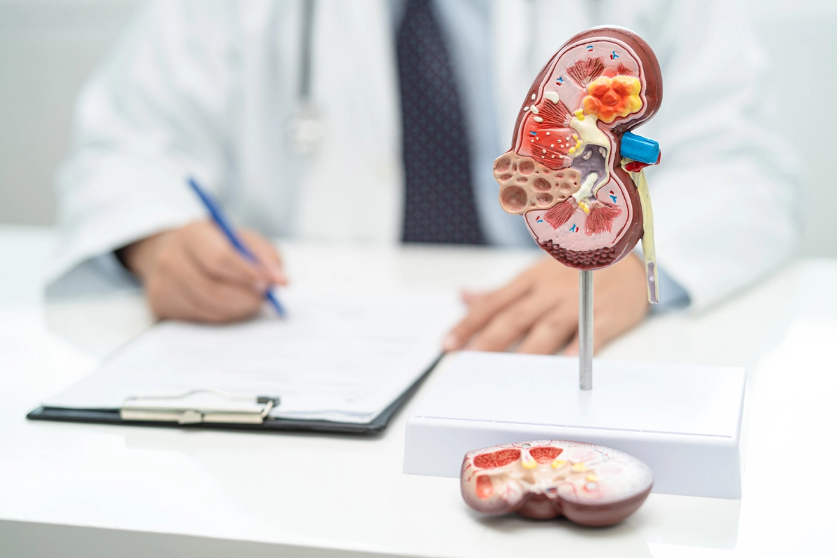 Consultație urologică, control urologic și ecografie renovezicală în Iași - Centrul Medical Tudor