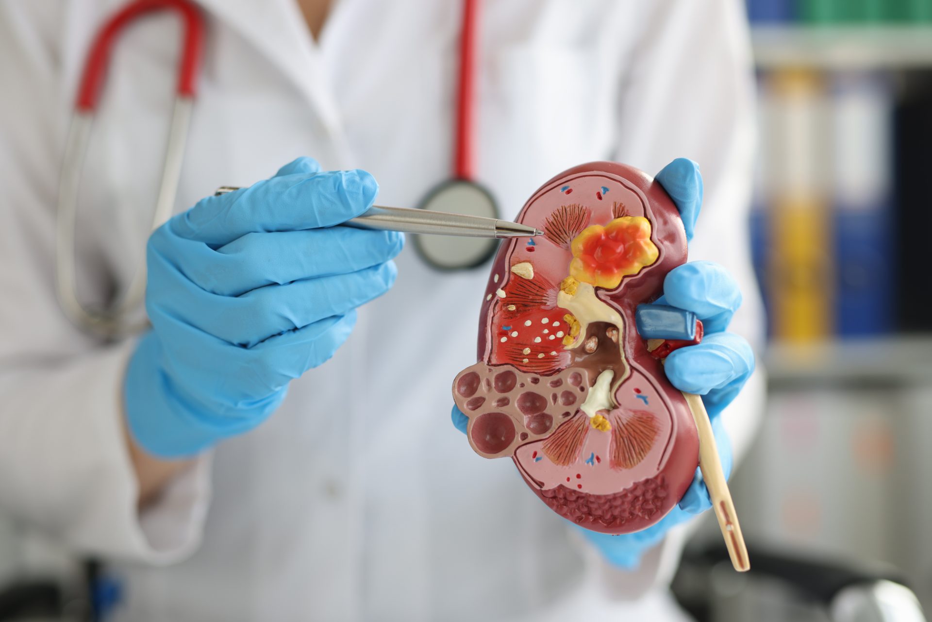 Investigații și intervenții urologice în Iași: recoltare uretrală, vasectomie și circumcizie - Centrul Medical Tudor